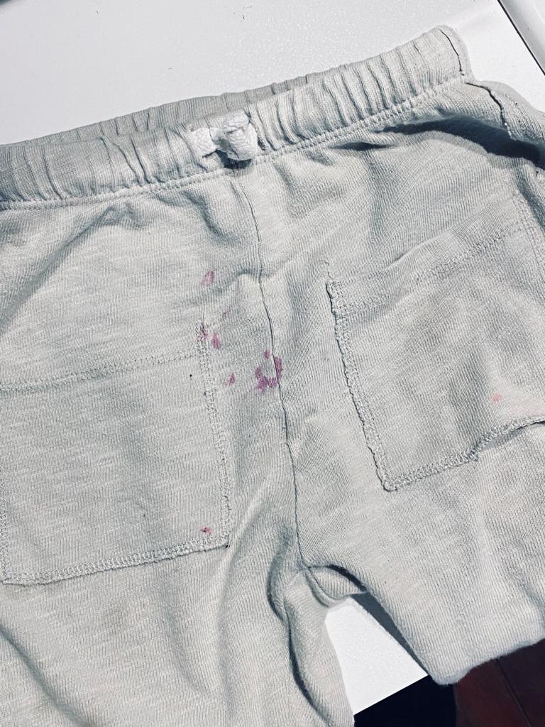 Eerste Hulp bij Vlekken